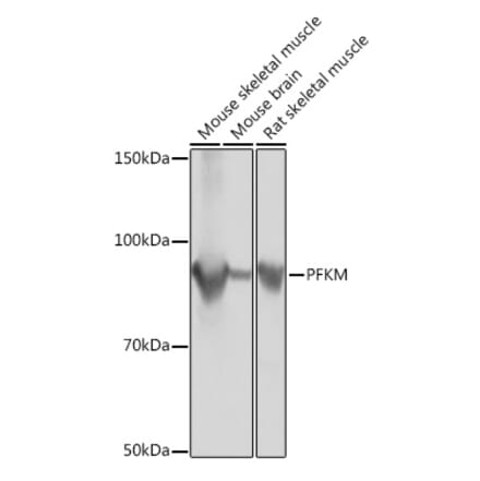 Western Blot - Anti-PFKM Antibody [ARC0819] (A305930) - Antibodies.com