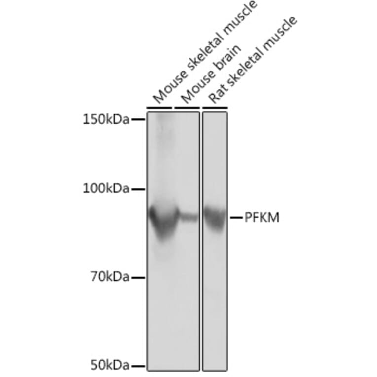 Western Blot - Anti-PFKM Antibody [ARC0819] (A305930) - Antibodies.com