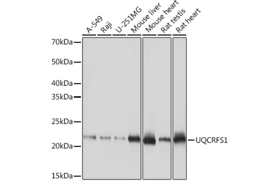 Western Blot - Anti-UQCRFS1/RISP Antibody [ARC1612] (A305931) - Antibodies.com