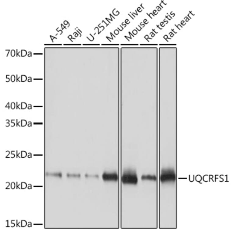 Western Blot - Anti-UQCRFS1/RISP Antibody [ARC1612] (A305931) - Antibodies.com