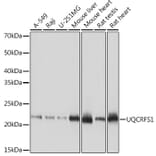 Western Blot - Anti-UQCRFS1/RISP Antibody [ARC1612] (A305931) - Antibodies.com