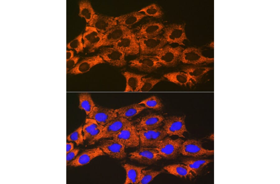 Immunofluorescence - Anti-UQCRFS1/RISP Antibody [ARC1612] (A305931) - Antibodies.com