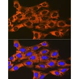Immunofluorescence - Anti-UQCRFS1/RISP Antibody [ARC1612] (A305931) - Antibodies.com