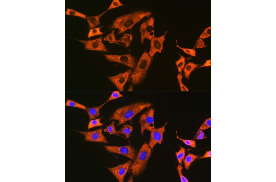 Immunofluorescence - Anti-UQCRFS1/RISP Antibody [ARC1612] (A305931) - Antibodies.com