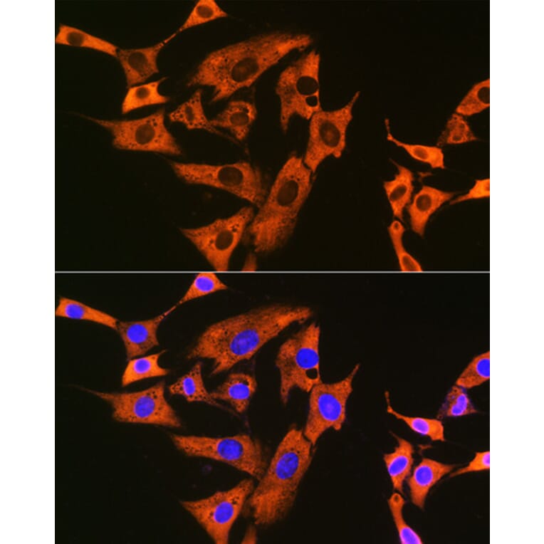 Immunofluorescence - Anti-UQCRFS1/RISP Antibody [ARC1612] (A305931) - Antibodies.com