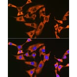 Immunofluorescence - Anti-UQCRFS1/RISP Antibody [ARC1612] (A305931) - Antibodies.com