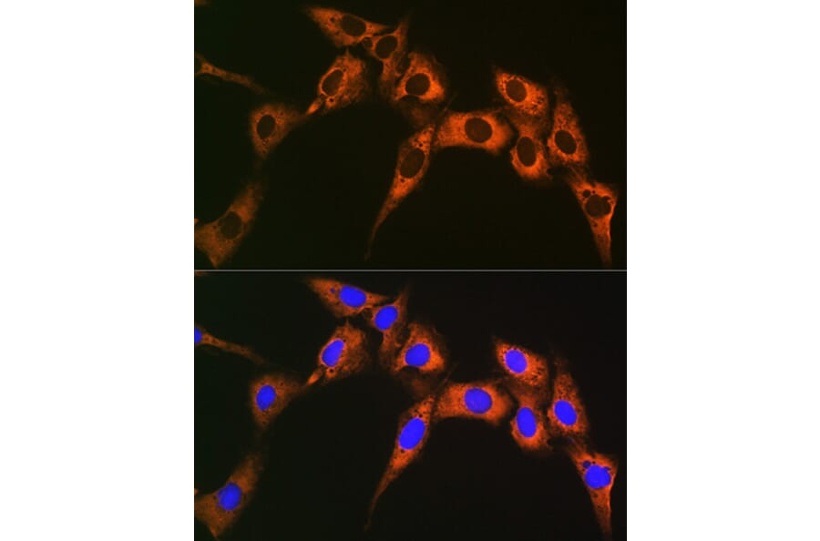 Immunofluorescence - Anti-UQCRFS1/RISP Antibody [ARC1612] (A305931) - Antibodies.com