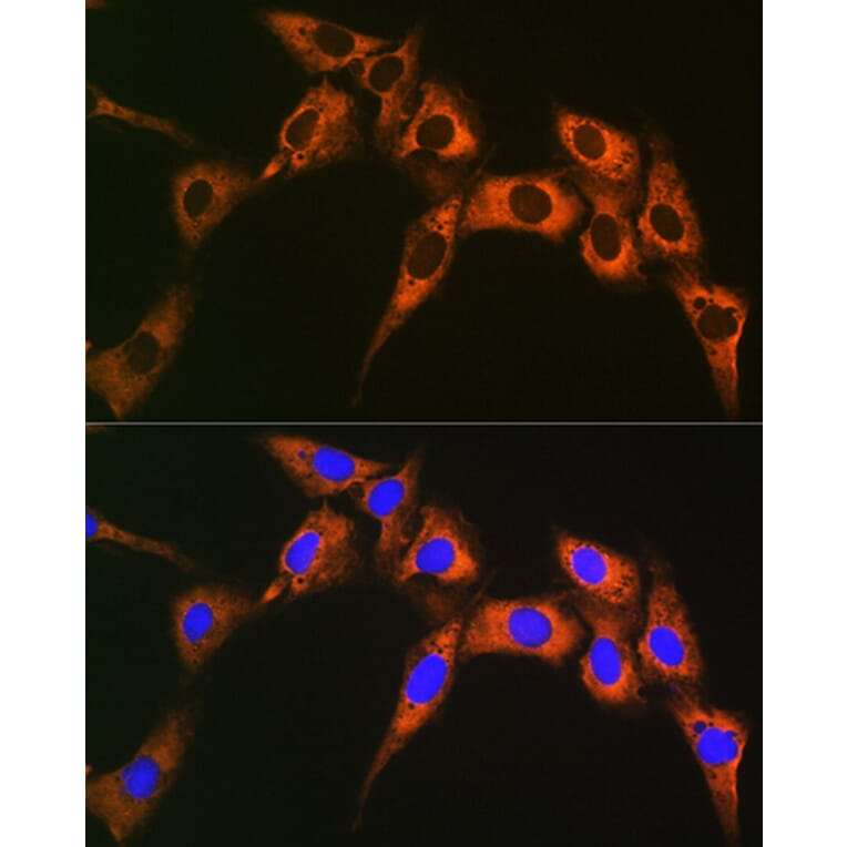 Immunofluorescence - Anti-UQCRFS1/RISP Antibody [ARC1612] (A305931) - Antibodies.com