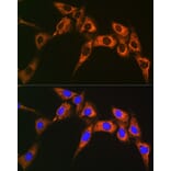 Immunofluorescence - Anti-UQCRFS1/RISP Antibody [ARC1612] (A305931) - Antibodies.com