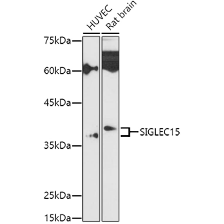Western Blot - Anti-SIGLEC15 Antibody (A305933) - Antibodies.com