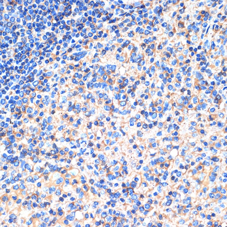 Immunohistochemistry - Anti-SIGLEC15 Antibody (A305933) - Antibodies.com