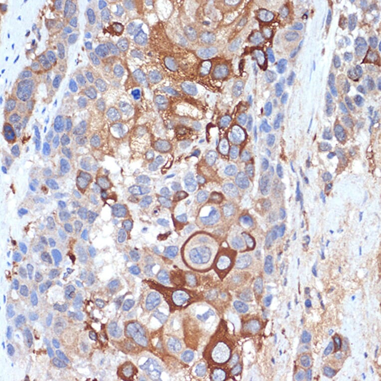 Immunohistochemistry - Anti-SIGLEC15 Antibody (A305933) - Antibodies.com