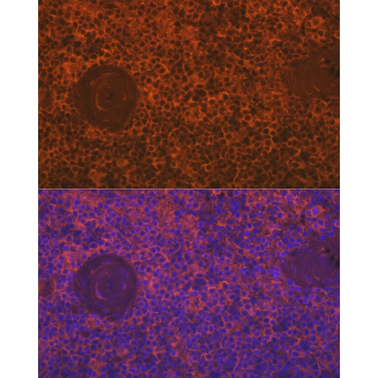 Immunofluorescence - Anti-SIGLEC15 Antibody (A305933) - Antibodies.com