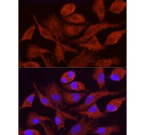Immunofluorescence - Anti-CYP4F11 Antibody (A305935) - Antibodies.com