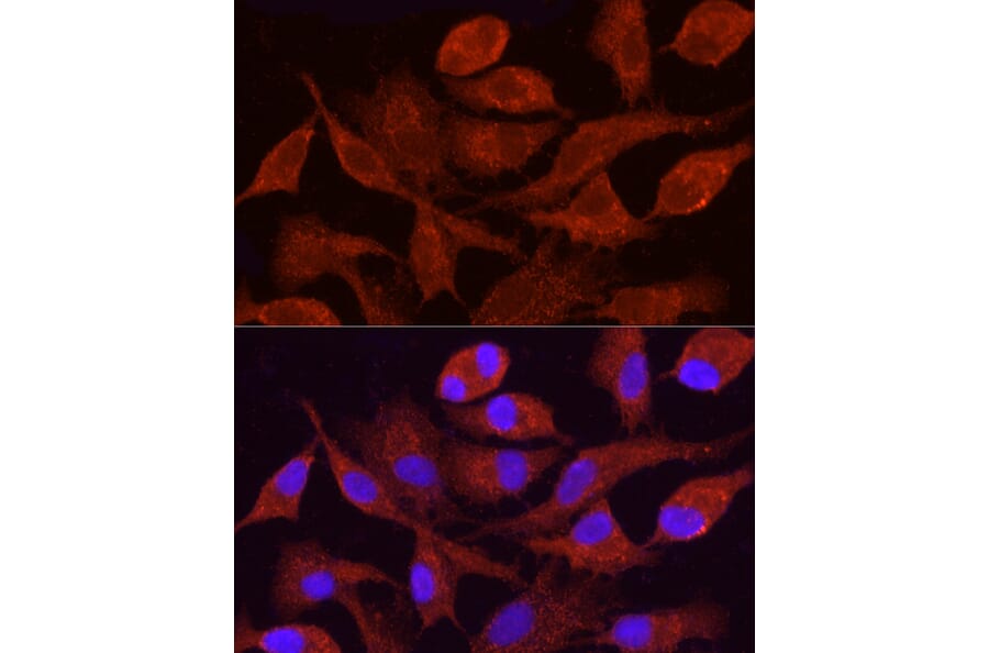Immunofluorescence - Anti-CYP4F11 Antibody (A305935) - Antibodies.com