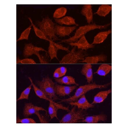 Immunofluorescence - Anti-CYP4F11 Antibody (A305935) - Antibodies.com