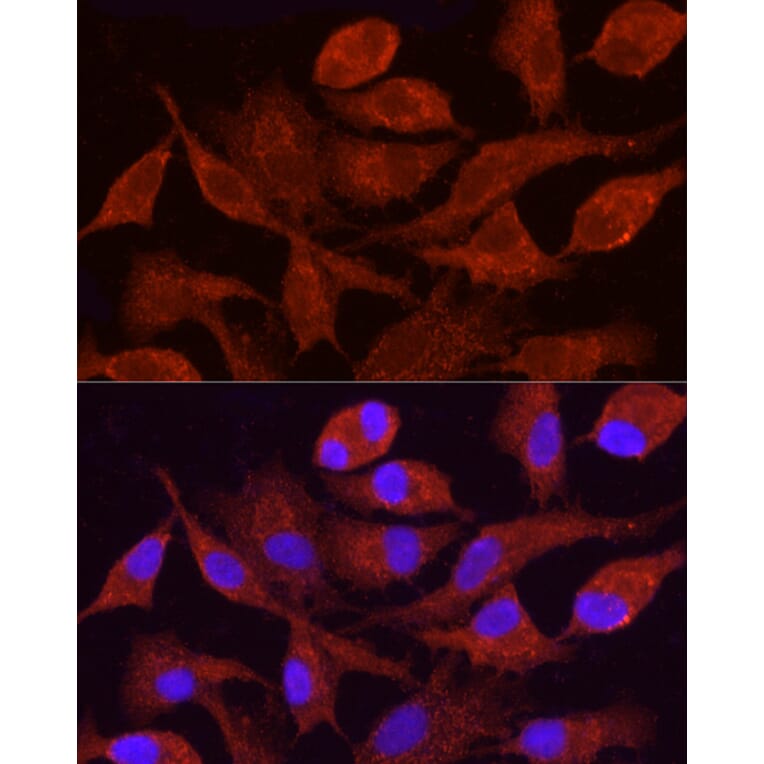 Immunofluorescence - Anti-CYP4F11 Antibody (A305935) - Antibodies.com