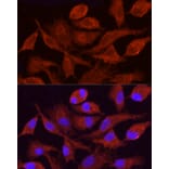 Immunofluorescence - Anti-CYP4F11 Antibody (A305935) - Antibodies.com