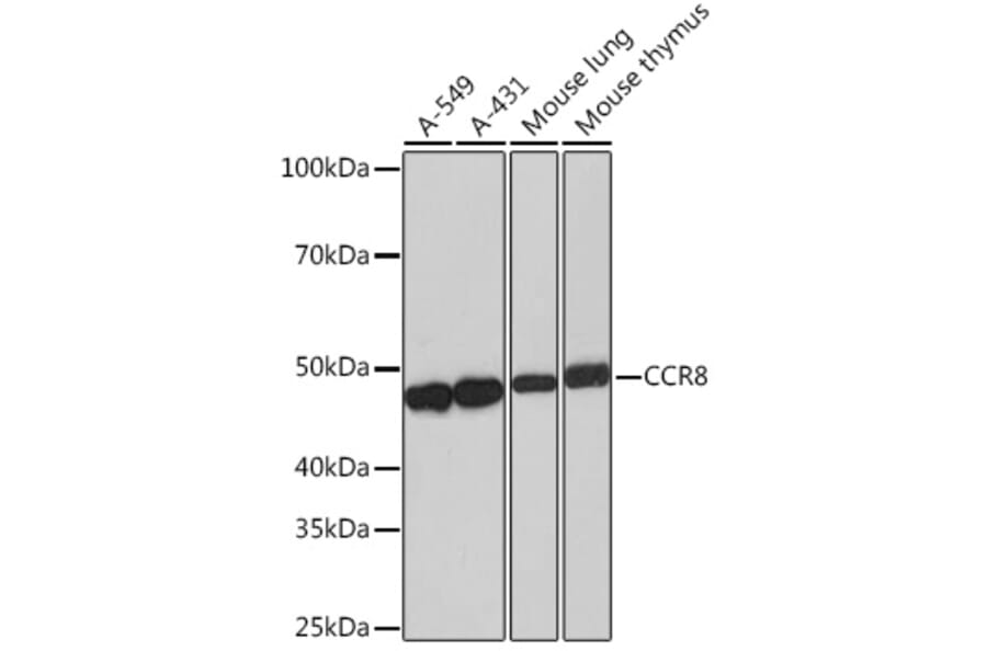 Western Blot - Anti-CCR8 Antibody [ARC0956] (A305936) - Antibodies.com