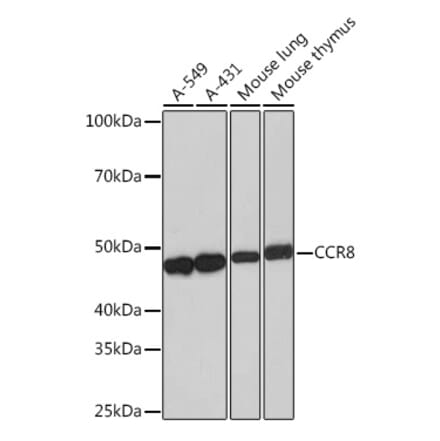 Western Blot - Anti-CCR8 Antibody [ARC0956] (A305936) - Antibodies.com