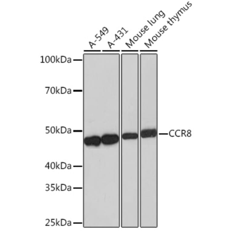 Western Blot - Anti-CCR8 Antibody [ARC0956] (A305936) - Antibodies.com