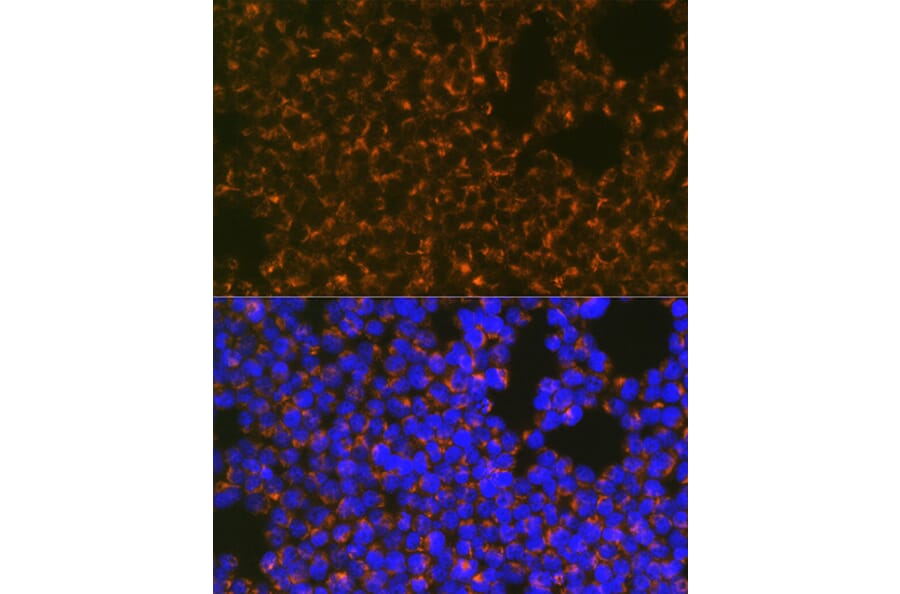 Immunofluorescence - Anti-CCR8 Antibody [ARC0956] (A305936) - Antibodies.com