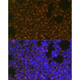 Immunofluorescence - Anti-CCR8 Antibody [ARC0956] (A305936) - Antibodies.com