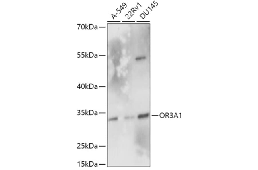 Western Blot - Anti-OR3A1 Antibody (A305937) - Antibodies.com