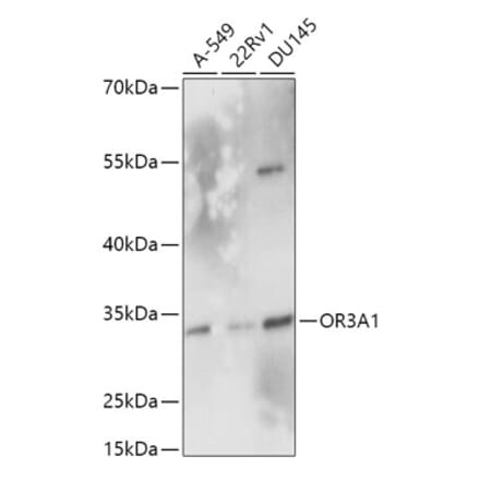 Western Blot - Anti-OR3A1 Antibody (A305937) - Antibodies.com
