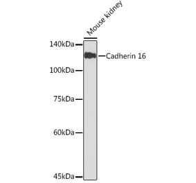 Western Blot - Anti-Cadherin 16 Antibody (A305939) - Antibodies.com