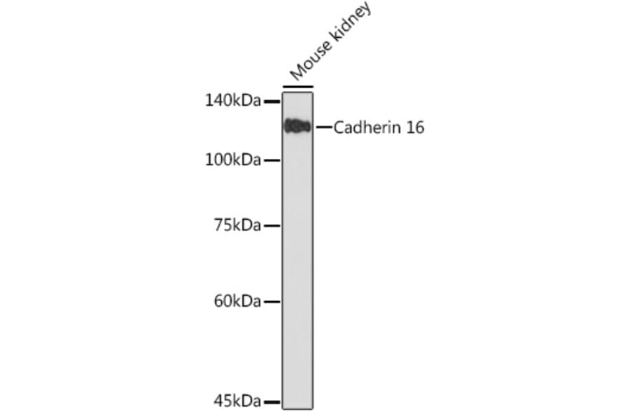 Western Blot - Anti-Cadherin 16 Antibody (A305939) - Antibodies.com