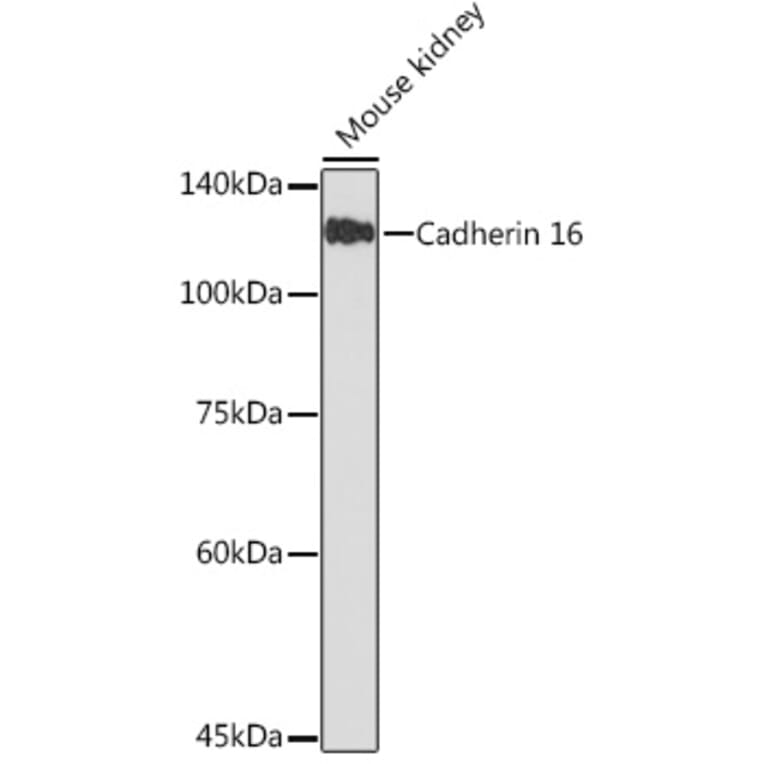 Western Blot - Anti-Cadherin 16 Antibody (A305939) - Antibodies.com