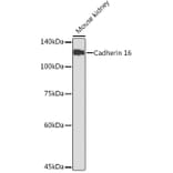 Western Blot - Anti-Cadherin 16 Antibody (A305939) - Antibodies.com