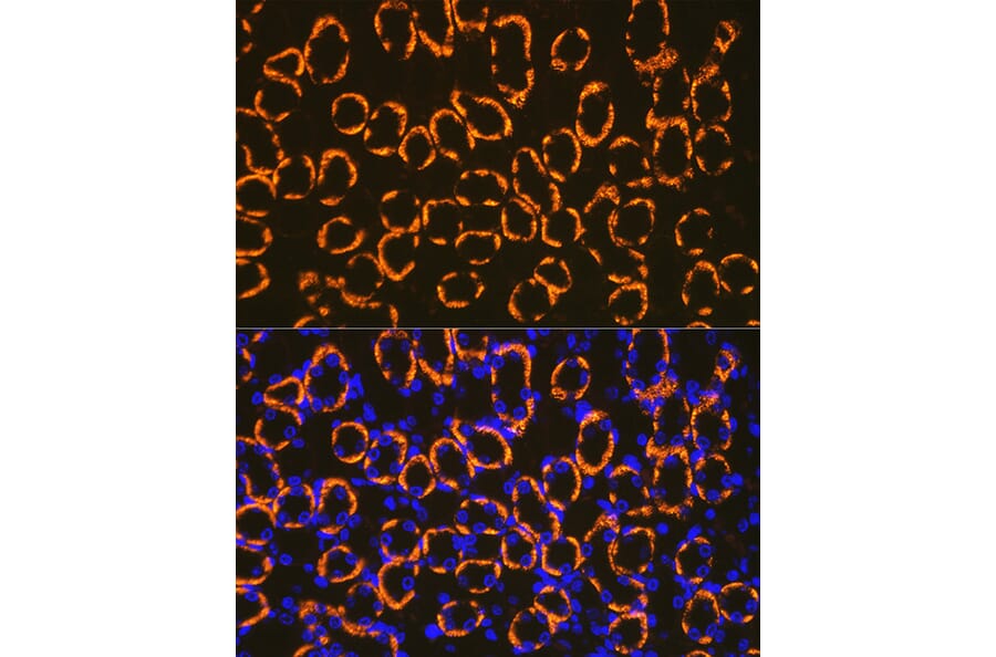 Immunofluorescence - Anti-Cadherin 16 Antibody (A305939) - Antibodies.com