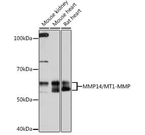 Western Blot - Anti-MMP14 Antibody [ARC0211] (A305940) - Antibodies.com
