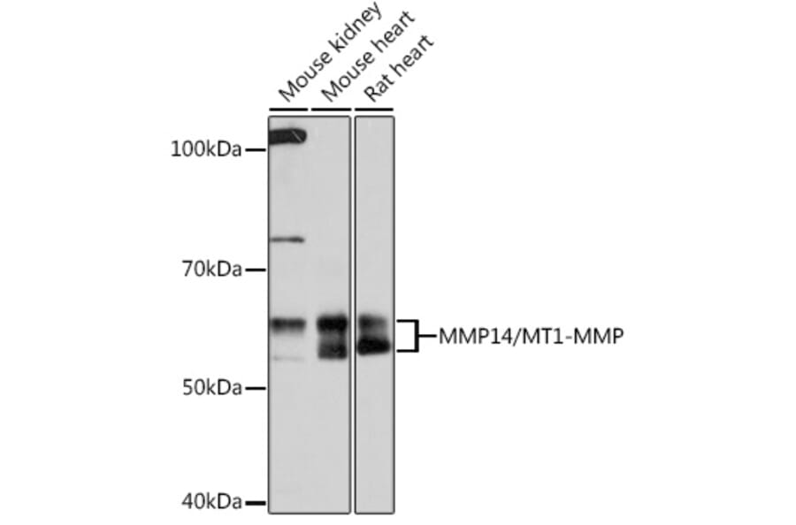 Western Blot - Anti-MMP14 Antibody [ARC0211] (A305940) - Antibodies.com