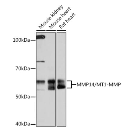 Western Blot - Anti-MMP14 Antibody [ARC0211] (A305940) - Antibodies.com