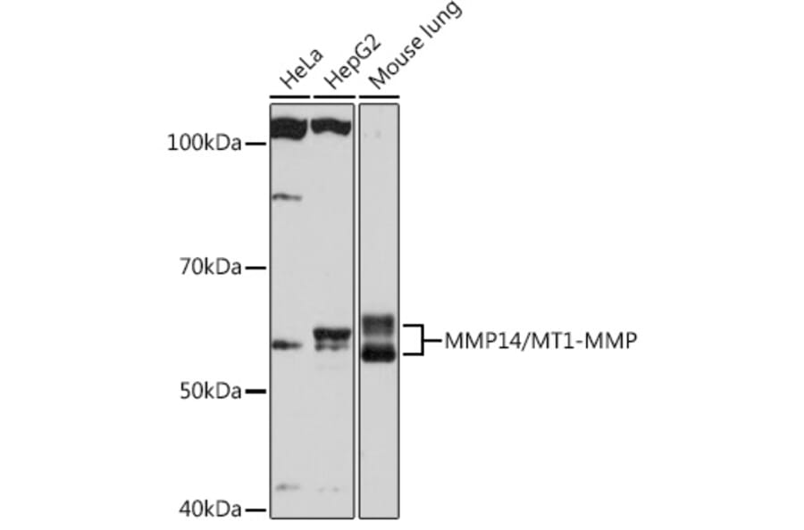 Western Blot - Anti-MMP14 Antibody [ARC0211] (A305940) - Antibodies.com