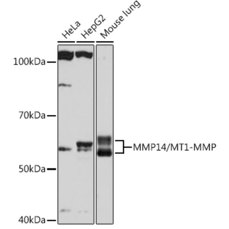 Western Blot - Anti-MMP14 Antibody [ARC0211] (A305940) - Antibodies.com