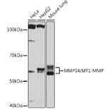 Western Blot - Anti-MMP14 Antibody [ARC0211] (A305940) - Antibodies.com