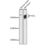 Western Blot - Anti-TET1 Antibody (A305941) - Antibodies.com