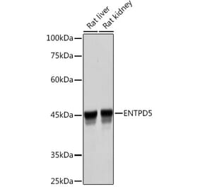 Western Blot - Anti-ENTPD5 Antibody [ARC2211] (A305942) - Antibodies.com