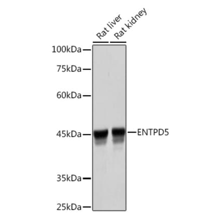 Western Blot - Anti-ENTPD5 Antibody [ARC2211] (A305942) - Antibodies.com