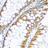 Immunohistochemistry - Anti-ENTPD5 Antibody [ARC2211] (A305942) - Antibodies.com