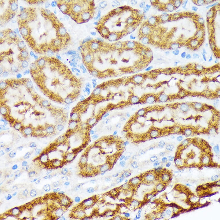 Immunohistochemistry - Anti-ENTPD5 Antibody [ARC2211] (A305942) - Antibodies.com