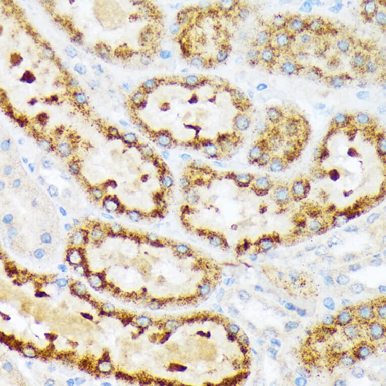 Immunohistochemistry - Anti-ENTPD5 Antibody [ARC2211] (A305942) - Antibodies.com