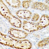 Immunohistochemistry - Anti-ENTPD5 Antibody [ARC2211] (A305942) - Antibodies.com