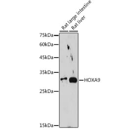 Western Blot - Anti-HOXA9 Antibody [ARC2423] (A305943) - Antibodies.com