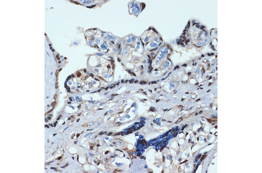 Immunohistochemistry - Anti-HOXA9 Antibody [ARC2423] (A305943) - Antibodies.com