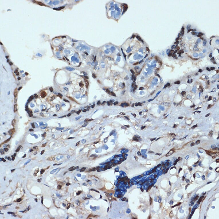 Immunohistochemistry - Anti-HOXA9 Antibody [ARC2423] (A305943) - Antibodies.com